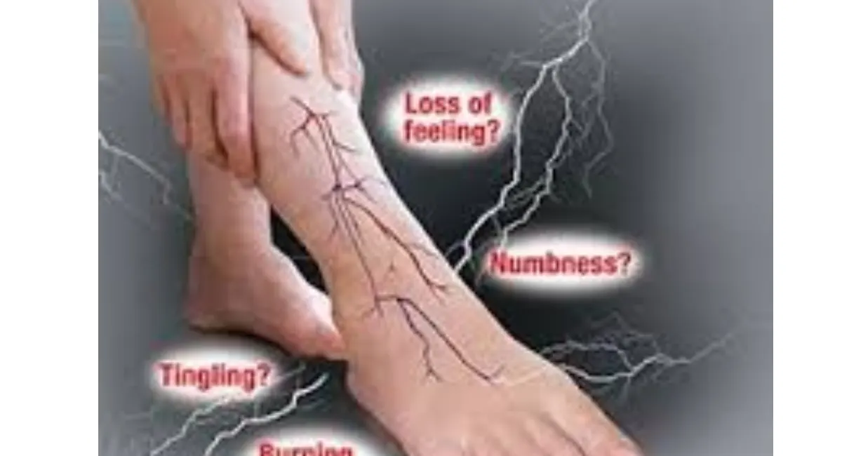 Natural-Remedies-for-Neuropathy-A-Complete-Guide-to-Relief-Without-Heavy-Medication-by-global-entrepreneur-insights